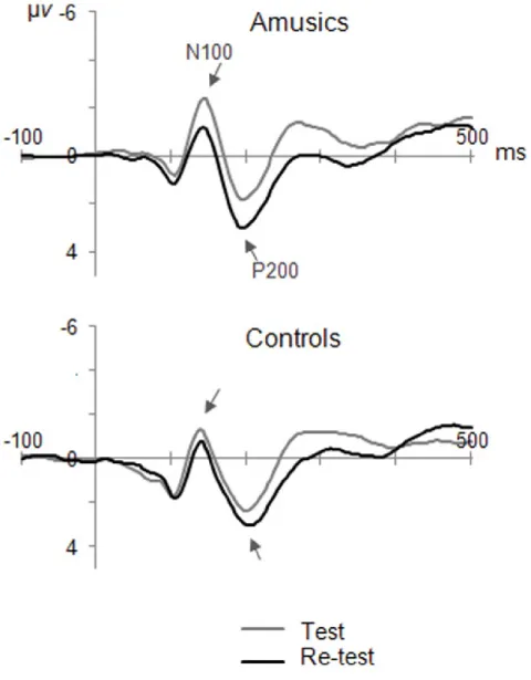 Figure 4.  Preattentive brain responses to equally frequent tones  