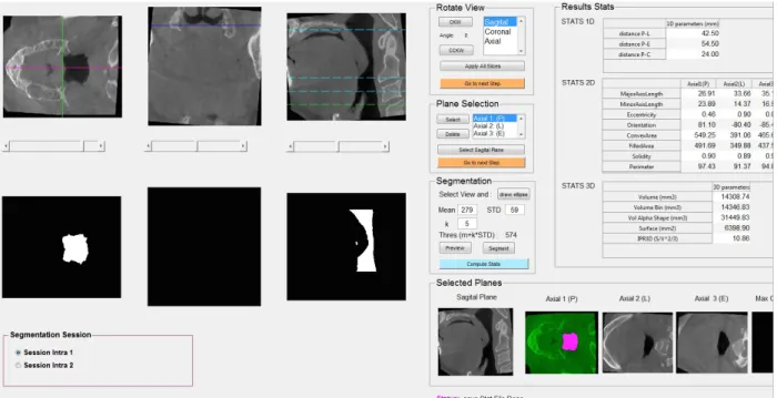 Figure 2: Section d’une capture d’écran d’une analyse radiologique, logiciel Matlab (MathWorks) 
