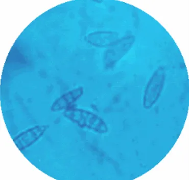 Figura Nº 4. Tinción de hongos patógenos  al humano M. gypseum (tiña de piel). 