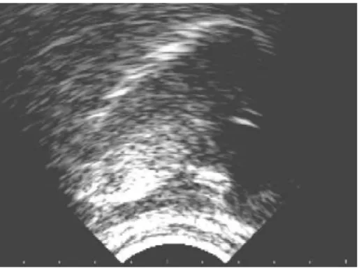 Figure 1 : image sagittale ultrason de la voyelle française [i]. L’avant se trouve à droite