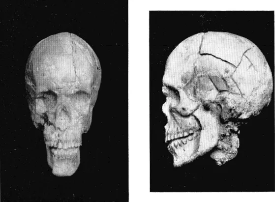 Fig.  6.  — Tancoigné.  Crâne, vu de face et  de profil  (avec porlion de la colonne vertébrale en  place)