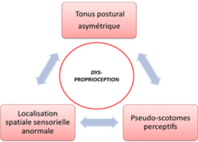 Figure 2 : Représentation schématique des altérations des 3 fonctions de la  proprioception conduisant au Syndrome de Déficience Posturale (Marino &amp; Quercia, 2007) 