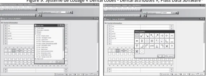 Figure 9: Système de codage « Dental codes - Dental attributes », Plass Data Software® 