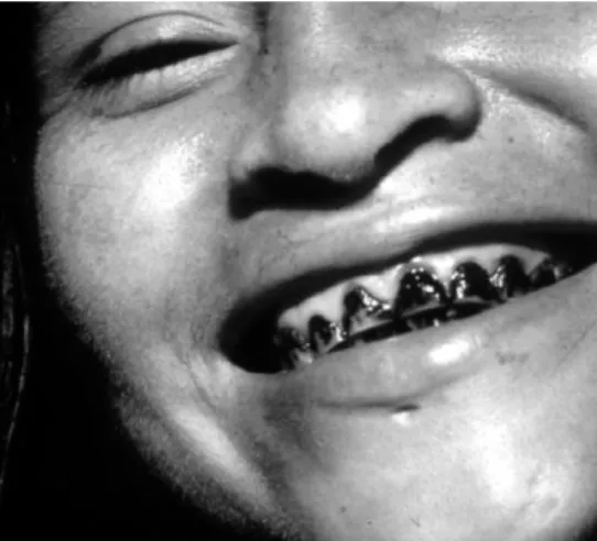 Figure 12 : Jeune fille Jivaro aux dents noircies 