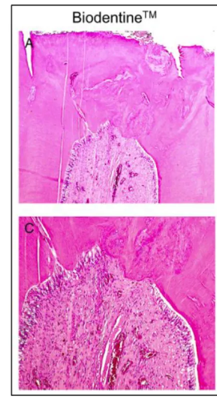 Figure 7 : Coupe histologique de prémolaire d’origine canine traitée par pulpotomie cervicale à la  Biodentine® 