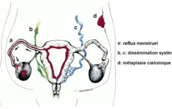 Figure 1 – Théories pathogéniques 