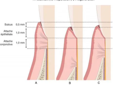 Figure 2 : Schéma des différents systèmes d’attache cicatriciels  