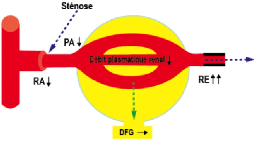 Figure 5 : Hémodynamique glomérulaire en cas de sténose de l’artère rénale, sous IEC/ARA II 35 