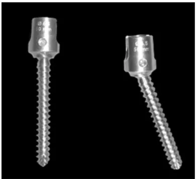 Fig. 4 : Vis charnière Saphinaz®. 