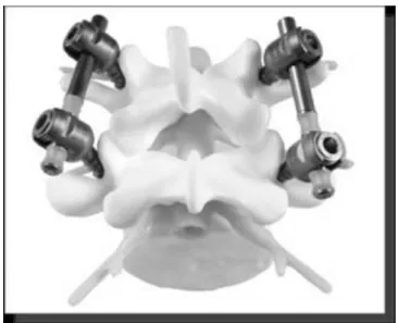 Fig. 6 : Nflex® 