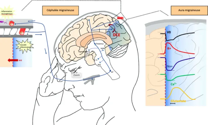 Figure 10 : Relation entre la dépression corticale envahissante et l’activation du système trigémino- trigémino-vasculaire 