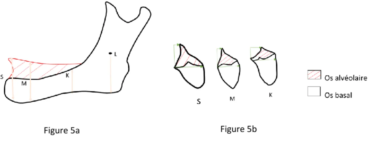 Figure 5 : Evolution de la résorption mandibulaire en fonction du plan de coupe 