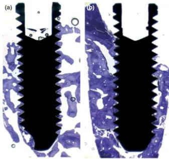 Figure 7 : Coupe histologique de biopsies de mini-implants prélevées sur une crête traitée par  allogreffe (a) et une crête traitée par autogreffe (b)