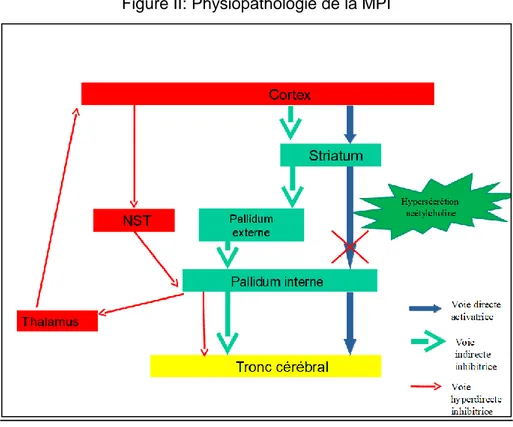 Figure II: Physiopathologie de la MPI 