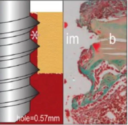 Figure 3 : Schéma d’un implant inséré chez une souris dans un site chirurgicalement préparé (à  gauche) avec une coupe histologique (à droite)