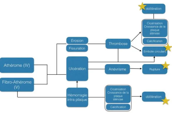 Figure 6 : Pathogénèse des lésions compliquées. Les étoiles marquent les complications  fréquemment associées à une symptomatologie clinique 