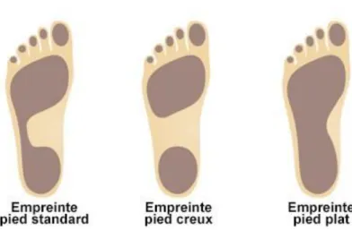 Figure 7 : Empreinte du pied au sol 