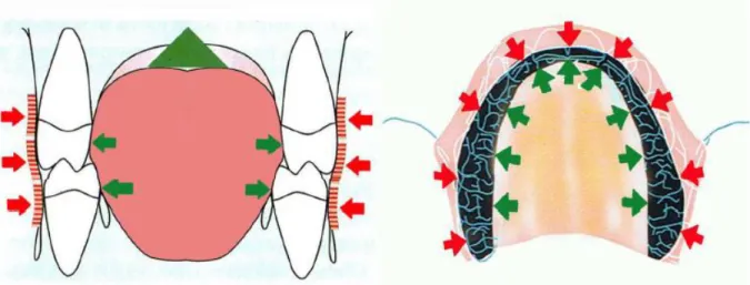 Figure 2 : Position haute de la langue, bon développement transversal des maxillaires 