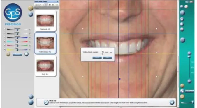 FIGURE 24 : UNE FOIS LE CALQUE MIS EN  PLACE, LE NOUVEAU SOURIRE EST  ENTIÈREMENT INSÉRÉ SUR LE PORTRAIT 