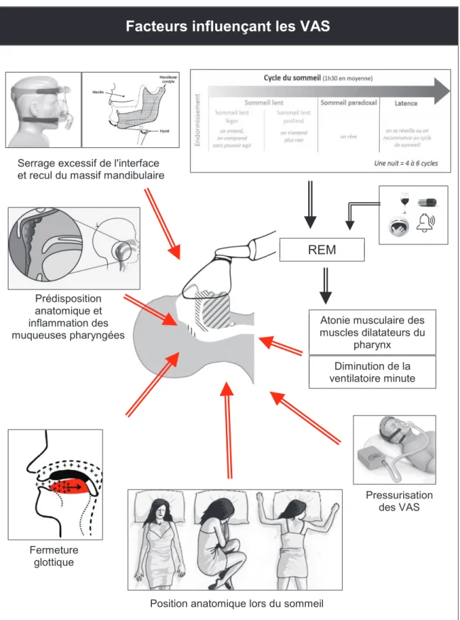 Figure 5 - Facteurs influents sur les VAS au cours du sommeil 