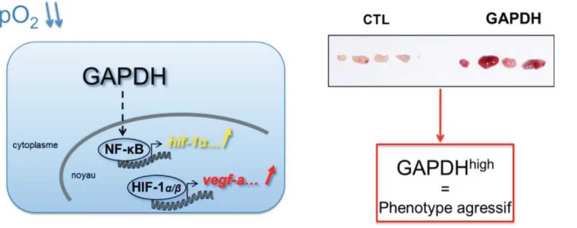 Figure 5. La surexpression de l’enzyme GAPDH est responsable d’un phénotype agressif dans un  modèle de lymphome B murin