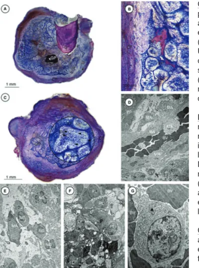 Figure n° 29 : Coupes histologiques d’un granulome épithélialisé. 