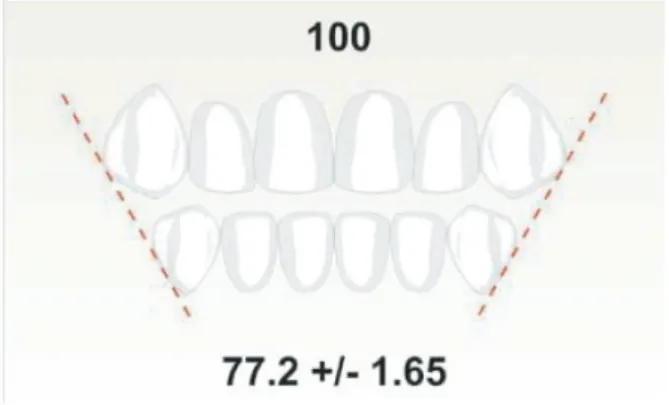 Figure 11 : Calcul de l'indice de Bolton antérieur en partant des faces distales des canines (32) 