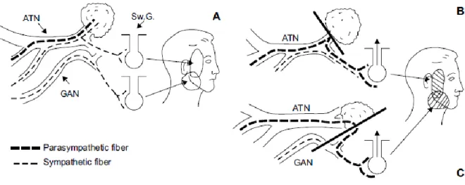 Figure 11 Schéma de le l’innervation parotidienne et des hypothèses physiopathologiques du  syndrome de Frey (29) 