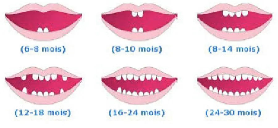 Figure 3 : &#34;Calendrier dentaire&#34;. Tiré de: http://www.mon-portail-grossesse.fr/bebe-est-la/les- http://www.mon-portail-grossesse.fr/bebe-est-la/les-examens-de-bebe/les-dents-de-lait.html