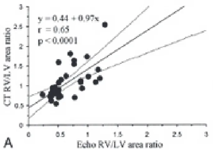 Figure 12.  (A) corrélation entre mesure du ratio diamètre VD/VG à l’échocardiographie et à  l’AST