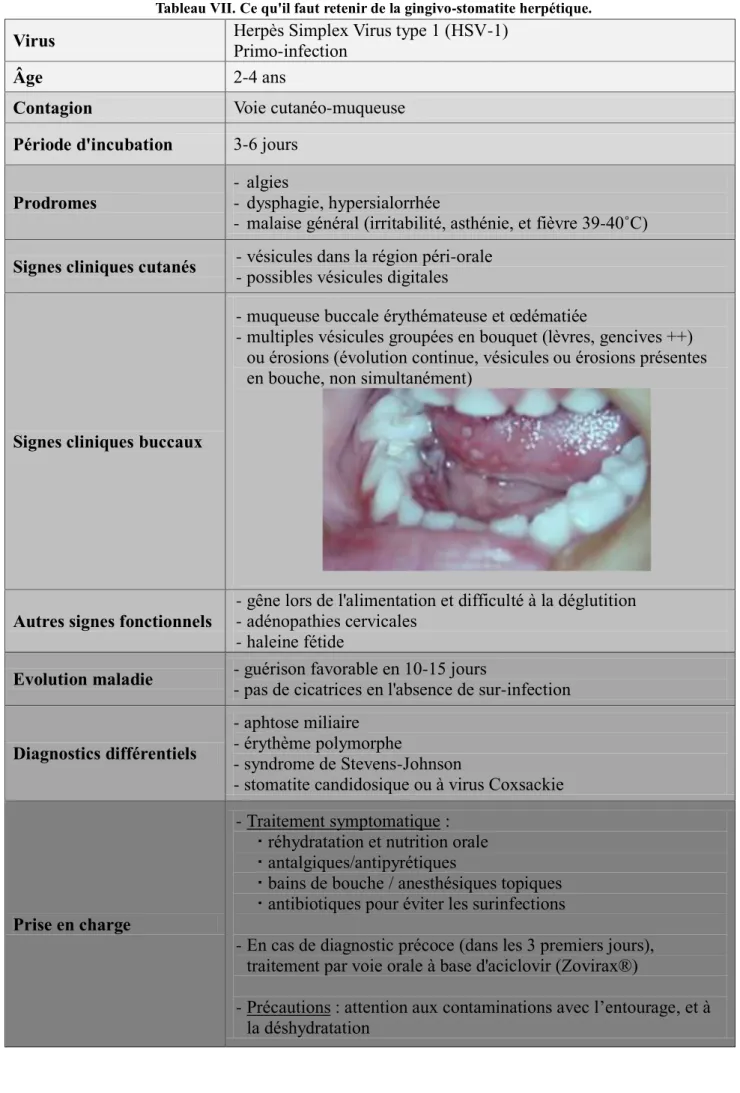 Tableau VII. Ce qu'il faut retenir de la gingivo-stomatite herpétique. 