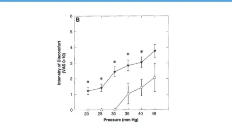 Figure 11 : Perception de la douleur viscérale mesurée par la méthode du  barostat. L’intensité de la douleur est plus élevée chez le patient souffrant  d’un  SII  (triangle  inversé)  pour  une  même  pression  insufflée  (p  &lt;  0,05)