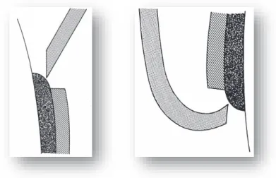 Figure 33 : Les pointes ultrasoniques pour la dépose de restaurations collées : le KJS (A) et le  KJC (B) 