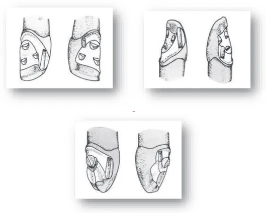 Figure 34 : Préparations pour un bridge collé sur une incisive centrale (A), une incisive  latérale (B) et une canine (C) 