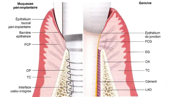 Figure 2 : Principales différences entre le modèle parodontal et le modèle péri-implantaire 
