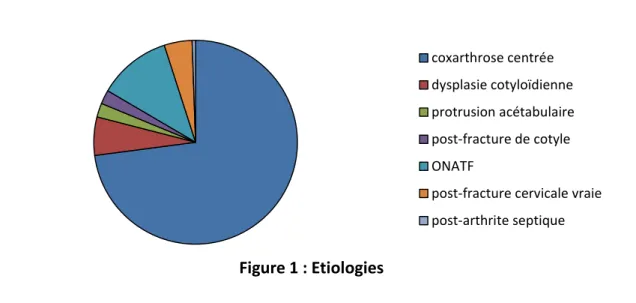 Figure 1 : Etiologies  coxarthrose centrée dysplasie cotyloïdienne protrusion acétabulairepost-fracture de cotyleONATF