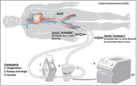 Figure 3 : a/  P i ipe de fo tio e e t de l ECMO  . adetec-coeur.fr)  