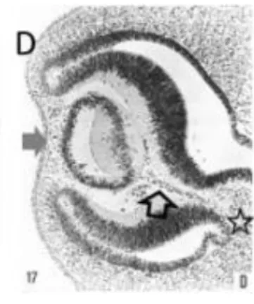 Figure 2 : Coupe histologique vers J42 passant la cupule et la fissure optique montrant les  vaisseaux hyaloïdiens (flèche vide) (56) 