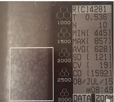 Figure 2 : Aspect d’un endothélium cornéen sain en microscopie spéculaire. 