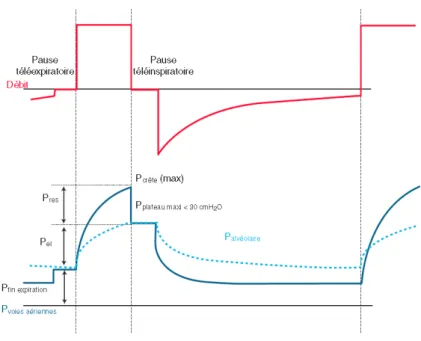Figure 22  169 : Courbes des débits et pressions en ventilation mécanique  