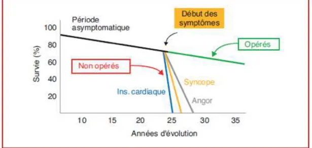 Figure 2: Histoire naturelle de la sténose aortique: survie avant et après apparition des symptômes chez  les patients opérés et non opérés