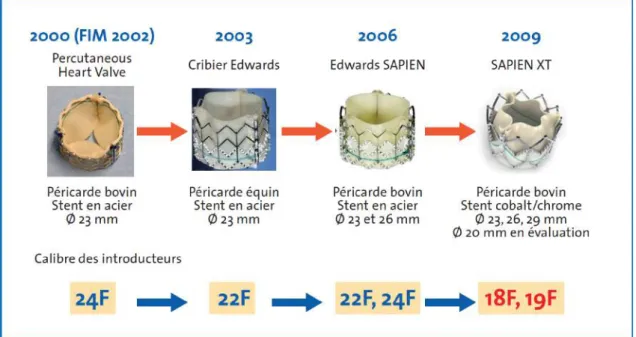 Figure 11: Evolution des valves Edwards ®  au fil du temps. [17]