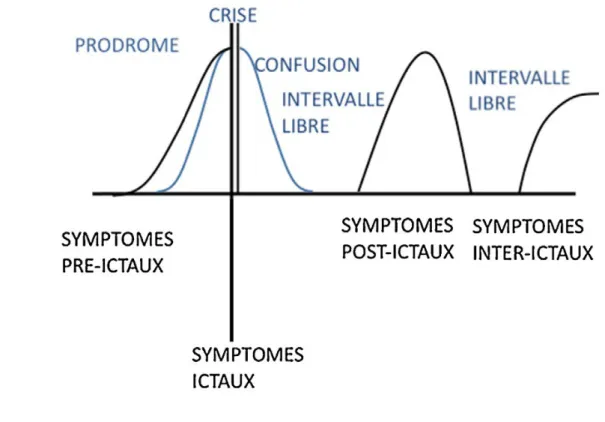 Figure 1     : syndromes péri-ictaux et inter-ictaux selon Yrondi et al (41)                   