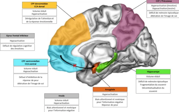 Figure B : lien entre les altérations anatomiques et fonctionnelles cérébrales et  les déficits cognitifs