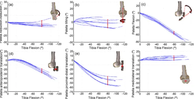 Figure 5 Experimental results: patellar kinematics (rotations and translations) described according to femoral coordinate system within knee ﬂexion—extension cycle.