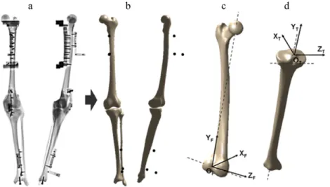 Fig. 1. (a) 2D images acquired with the stereoradiographic system. (b) Reconstruction of the femur and tibia 3D digital models together with the photogrammetric markers.