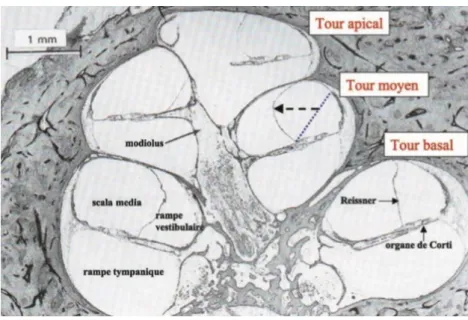 Figure  1:  Coupes  histologiques  longitudinales  de  cochlée.  La  distension  (flèche  en  pointillé)  de  la  membrane  de  Reissner,  structure  qui  sépare  le  compartiment  endolymphatique,  la  scala  média  ou  canal  cochléaire  et  le  comparti