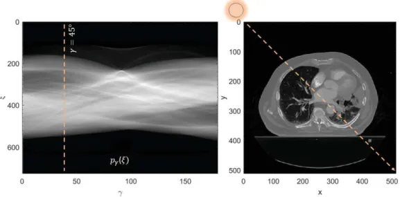 Figure 0.3. Schéma du principe de la reconstruction tomodensitométrique avec à droite une image représentant la prise de donnée puis à gauche le  sino-gramme correspondant.