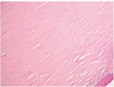 Figure 4 : Photographie en microscopie optique coloration hématoxiline, éosine, safran : stroma cornéen.,  source EMC 8