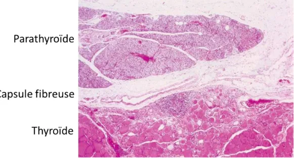 Figure 3 : Vue microscopique d’une parathyroïde normale divisée en lobules, avec sa capsule  fibreuse et le parenchyme thyroïdien au contact